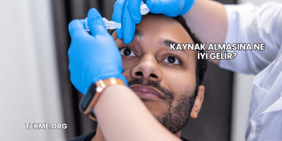 Kaynak Almasına Ne İyi Gelir?