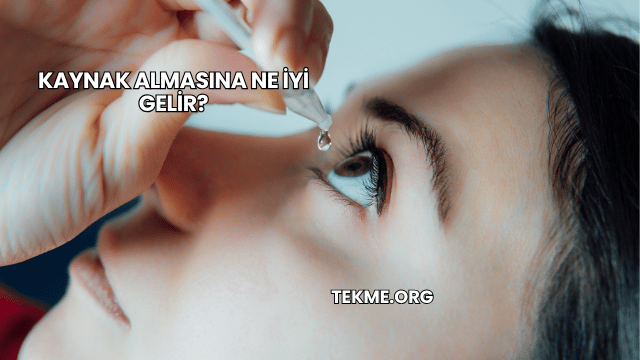 Kaynak Almasına Ne İyi Gelir?