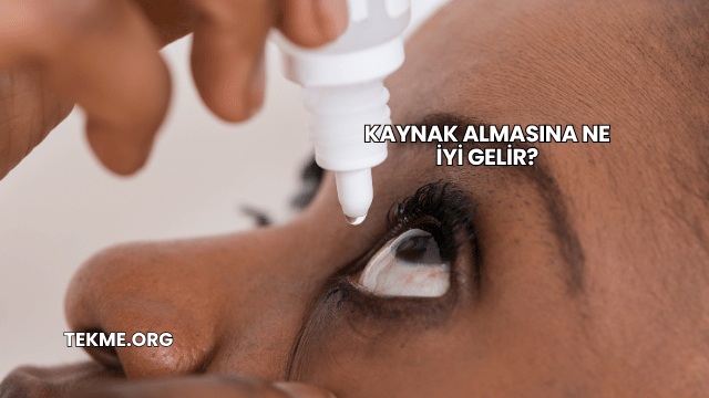 Kaynak Almasına Ne İyi Gelir?