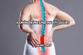 Kemik Erimesine Ne İyi Gelir?