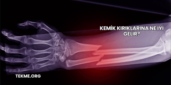 Kemik Kırıklarına Ne İyi Gelir?