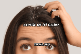 Kepeğe Ne İyi Gelir?