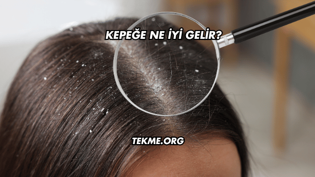 Kepeğe Ne İyi Gelir?
