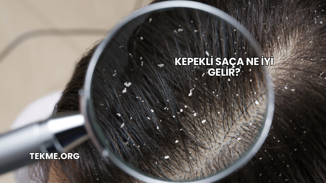 Kepekli Saça Ne İyi Gelir?