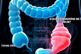 Kolon Kanserine Ne İyi Gelir?