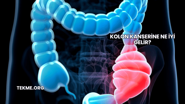 Kolon Kanserine Ne İyi Gelir?