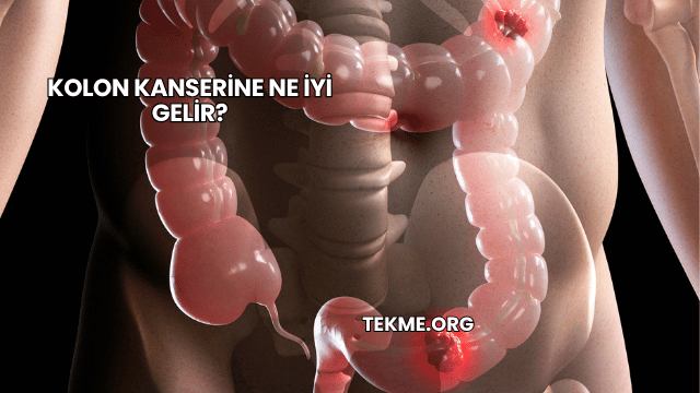 Kolon Kanserine Ne İyi Gelir?
