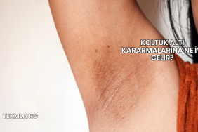 Koltuk Altı Kararmalarına Ne İyi Gelir?