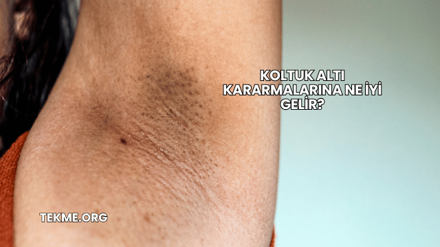 Koltuk Altı Kararmalarına Ne İyi Gelir?