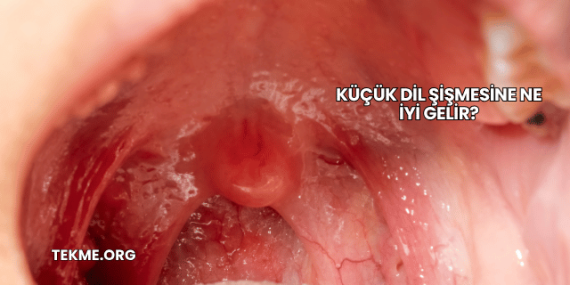 Küçük Dil Şişmesine Ne İyi Gelir?