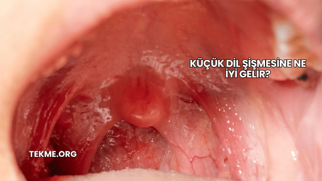 Küçük Dil Şişmesine Ne İyi Gelir?