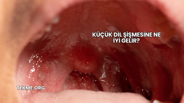 Küçük Dil Şişmesine Ne İyi Gelir?