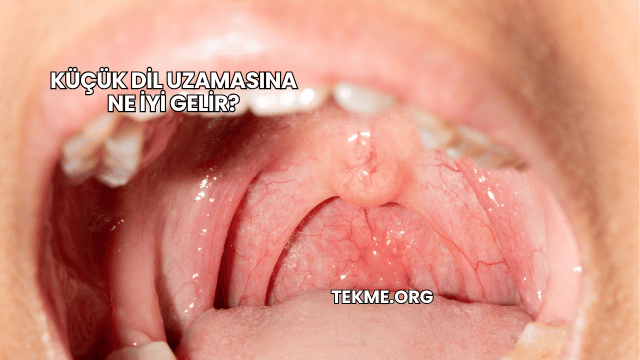 Küçük Dil Uzamasına Ne İyi Gelir?