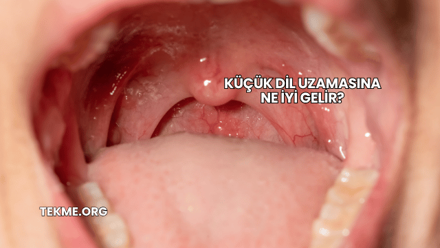 Küçük Dil Uzamasına Ne İyi Gelir?
