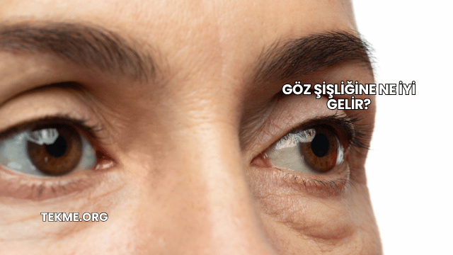 Göz Şişliğine Ne İyi Gelir?