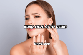 Kuru Cilde Ne İyi Gelir?