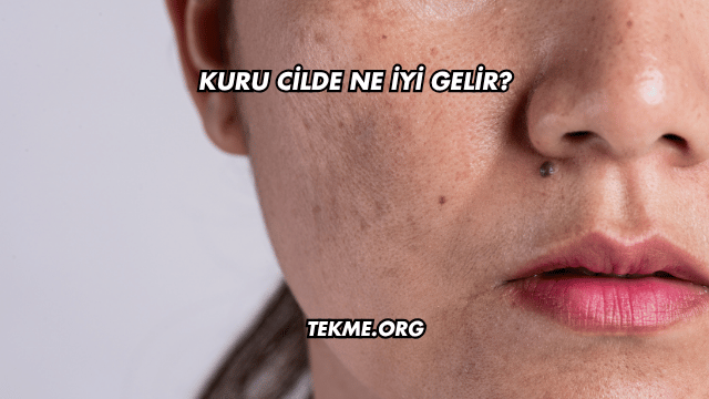 Kuru Cilde Ne İyi Gelir?