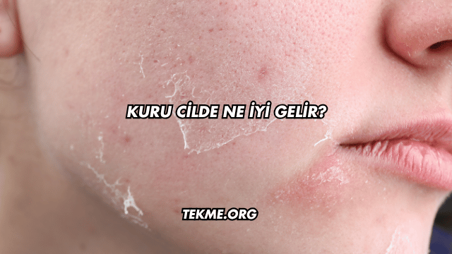 Kuru Cilde Ne İyi Gelir?