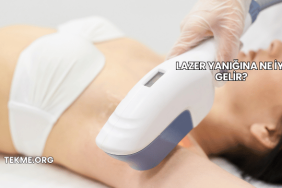 Lazer Yanığına Ne İyi Gelir?
