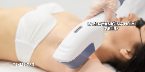 Lazer Yanığına Ne İyi Gelir?