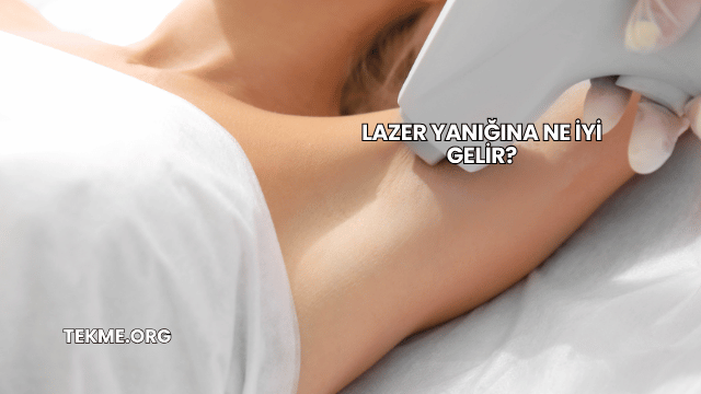 Lazer Yanığına Ne İyi Gelir?