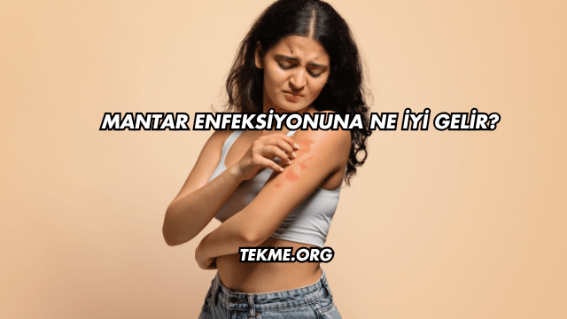 Mantar Enfeksiyonuna Ne İyi Gelir?