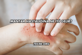 Mantar Hastalığına Ne İyi Gelir?