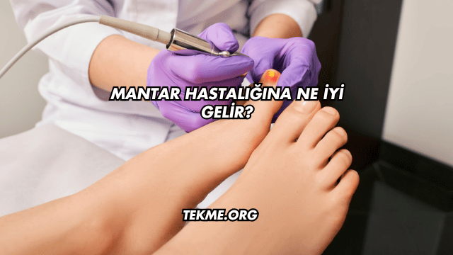 Mantar Hastalığına Ne İyi Gelir?