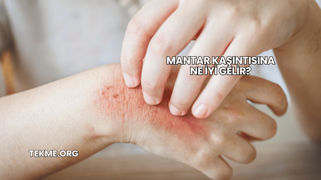 Mantar Kaşıntısına Ne İyi Gelir?