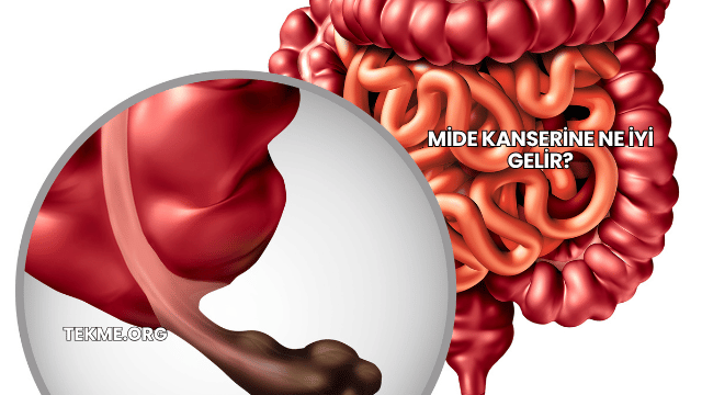 Mide Kanserine Ne İyi Gelir?