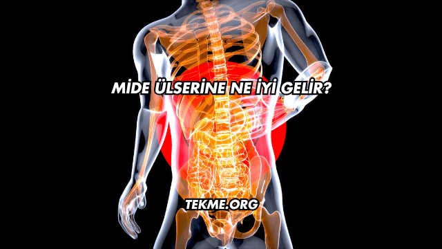 Mide Ülserine Ne İyi Gelir?