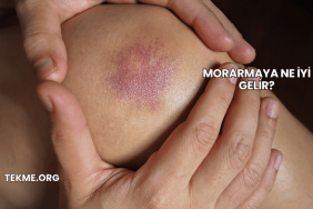 Morarmaya Ne İyi Gelir?