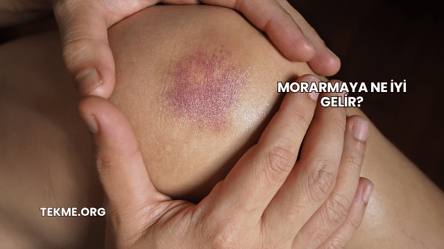 Morarmaya Ne İyi Gelir?