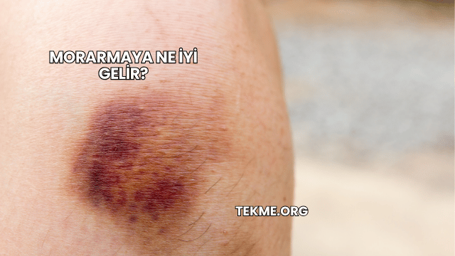 Morarmaya Ne İyi Gelir?