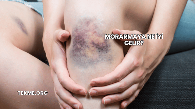 Morarmaya Ne İyi Gelir?