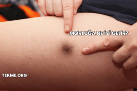 Morluğa Ne İyi Gelir?