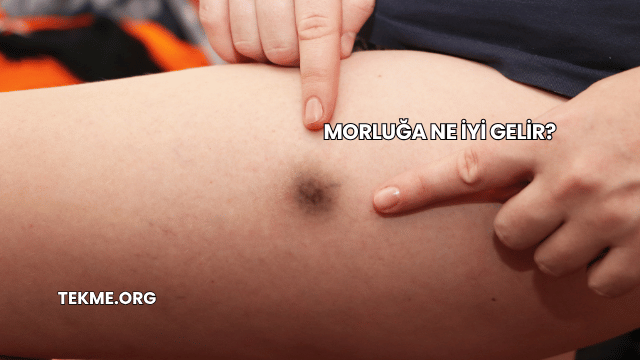 Morluğa Ne İyi Gelir?