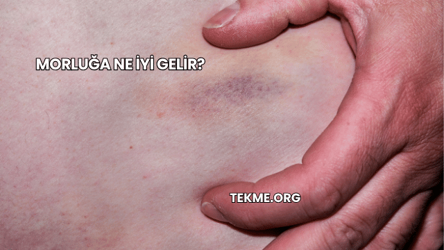 Morluğa Ne İyi Gelir?