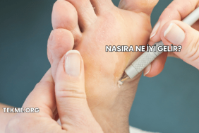 Nasıra Ne İyi Gelir?