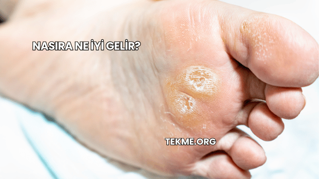 Nasıra Ne İyi Gelir?