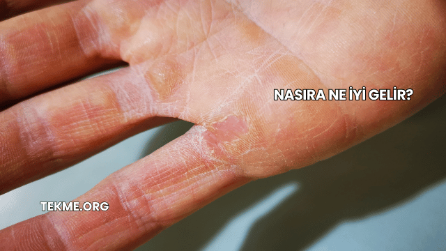 Nasıra Ne İyi Gelir?