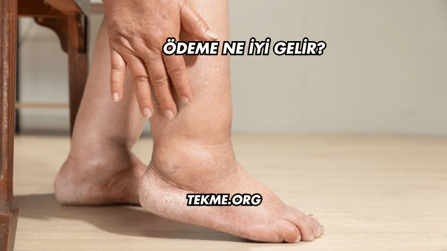 Ödeme Ne İyi Gelir?