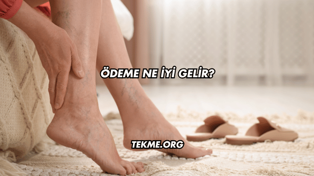 Ödeme Ne İyi Gelir?