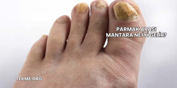 Parmak Arası Mantara Ne İyi Gelir?