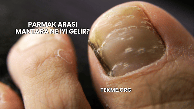 Parmak Arası Mantara Ne İyi Gelir?