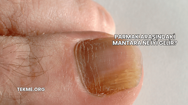 Parmak Arasındaki Mantara Ne İyi Gelir?