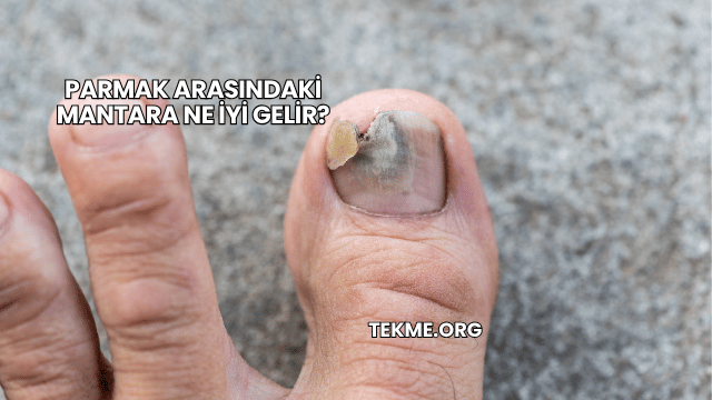 Parmak Arasındaki Mantara Ne İyi Gelir?