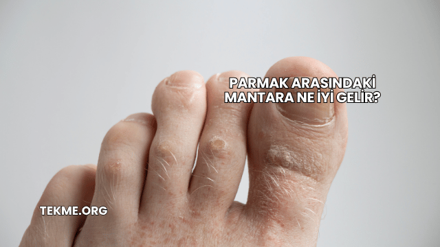 Parmak Arasındaki Mantara Ne İyi Gelir?