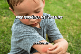 Pire Isırığına Ne İyi Gelir?