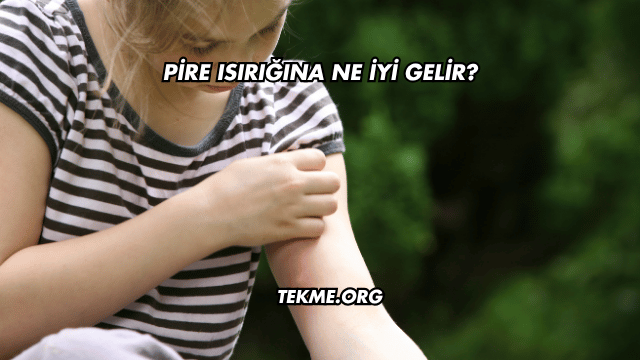 Pire Isırığına Ne İyi Gelir?